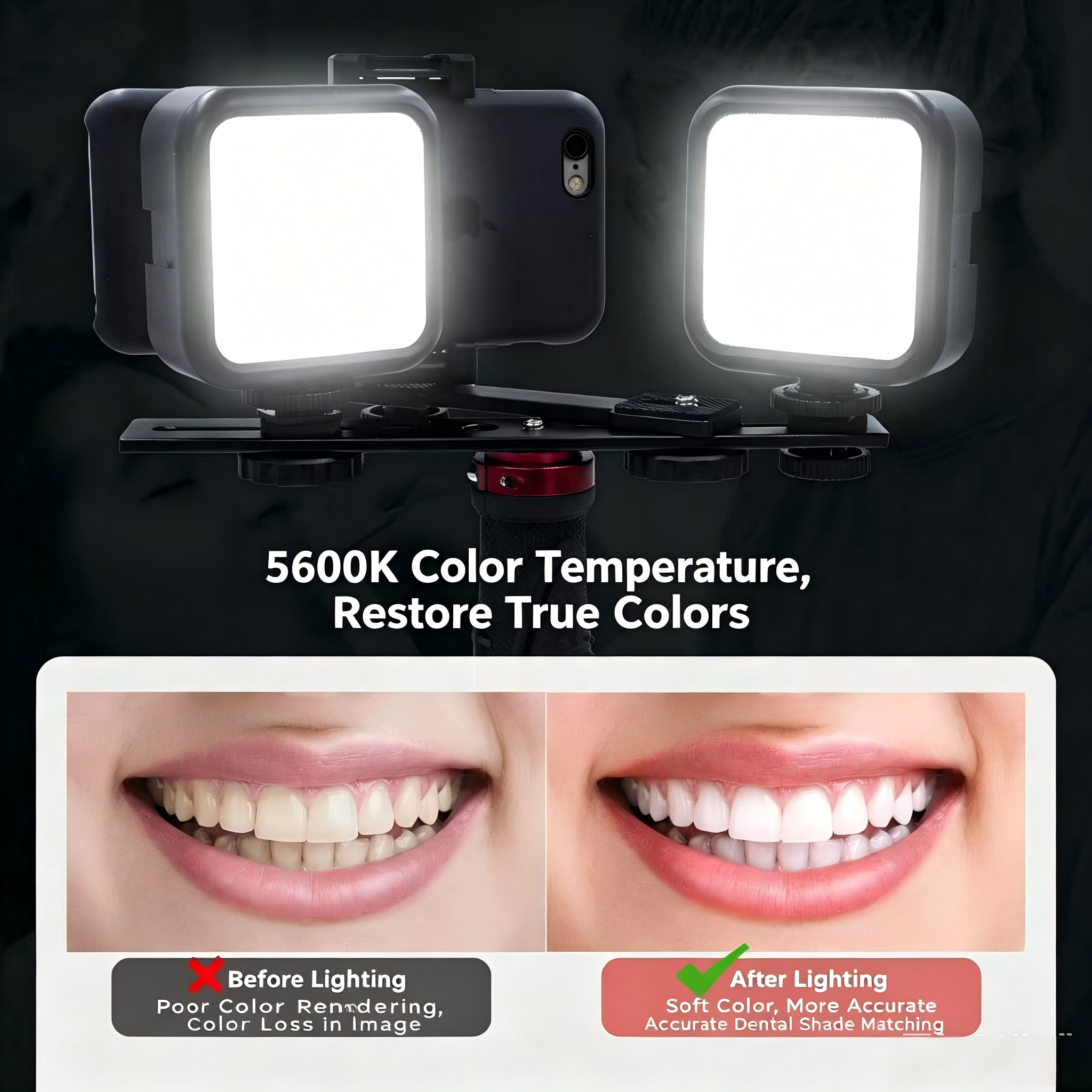 Portable Dental Photography Li – Photography Lighting Definition recenzja i cena
