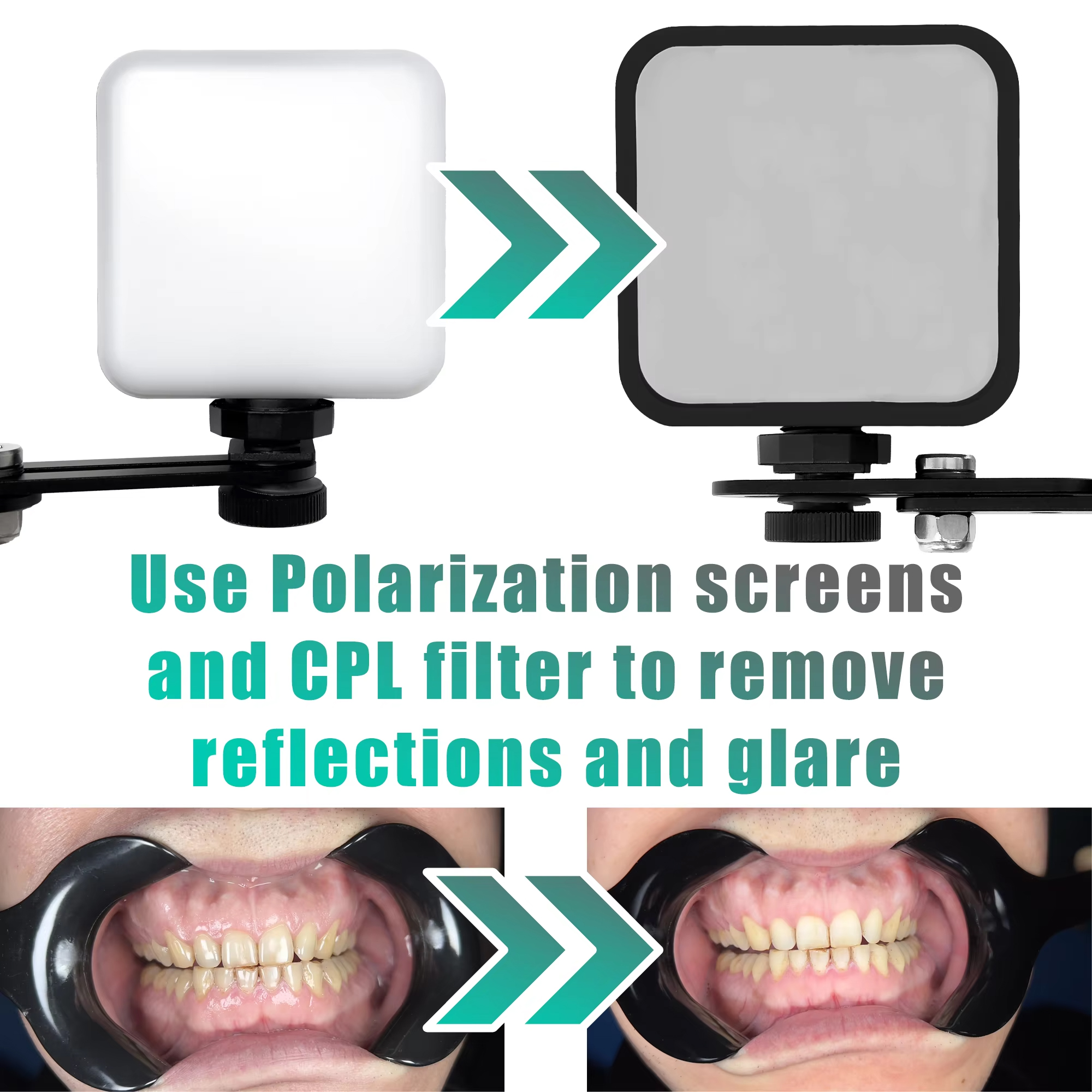 Adjustable Dental Photo Light  – Photography Lighting Essentials recenzja i cena